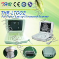 Scanner à ultrasons numérique complet Thr-Lt002